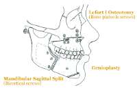 diagram-of-face.gif