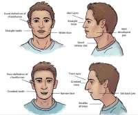 mouth-breathing-face-vs-nose-breather.jpg