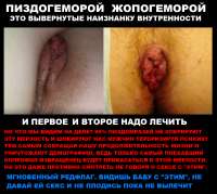 БРУХЛЯ И ГЕМОРРОЙ РЕДФЛАГ.PNG