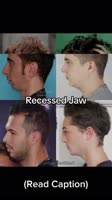 Jaw Types (Explained)👇Soft jaw, sharp jaw, or recessed jawHere’s what makes the difference-🦴 B.mp4
