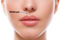 philtrum[1].jpeg