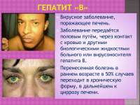 slide21-l.jpg