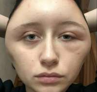3.jpeg