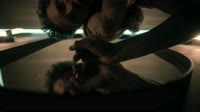Хирург - Вильма.webm