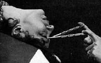 Lobotomy.jpg