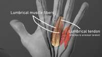 HoopersBetaEp83LumbricalsEmileModesitt04292021.00023300.Still009.jpg
