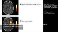 200515862647155860.mp4