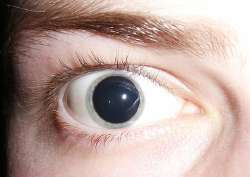 EYELSD.jpg